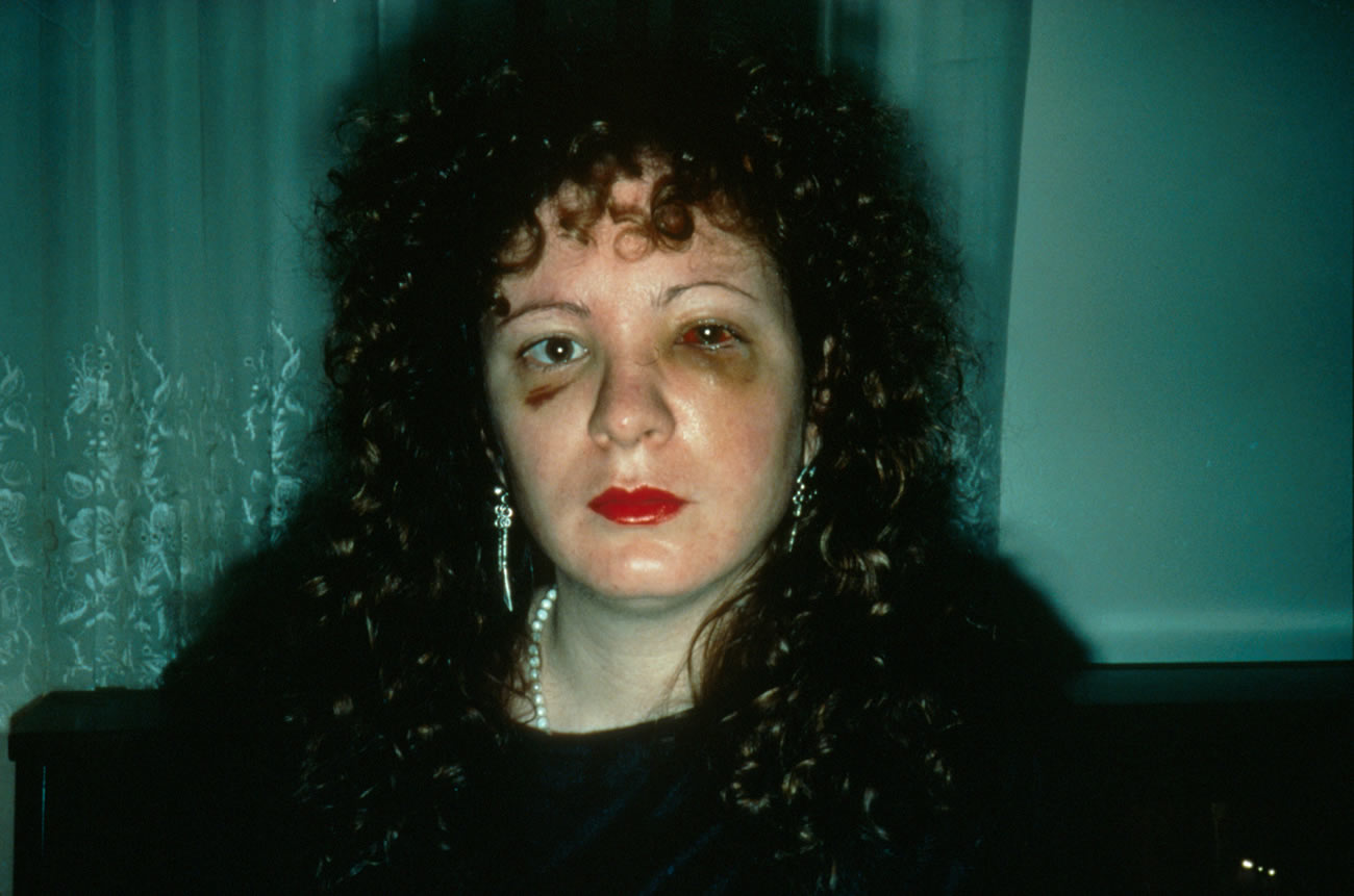 self portrait nan goldin