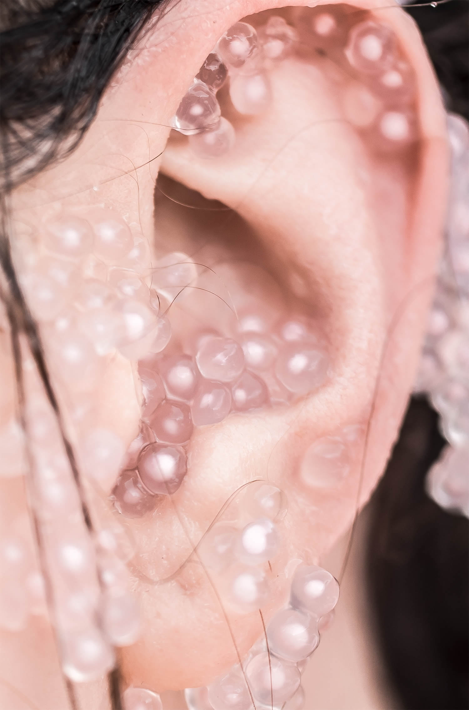 gel beads in ear, flush photo series