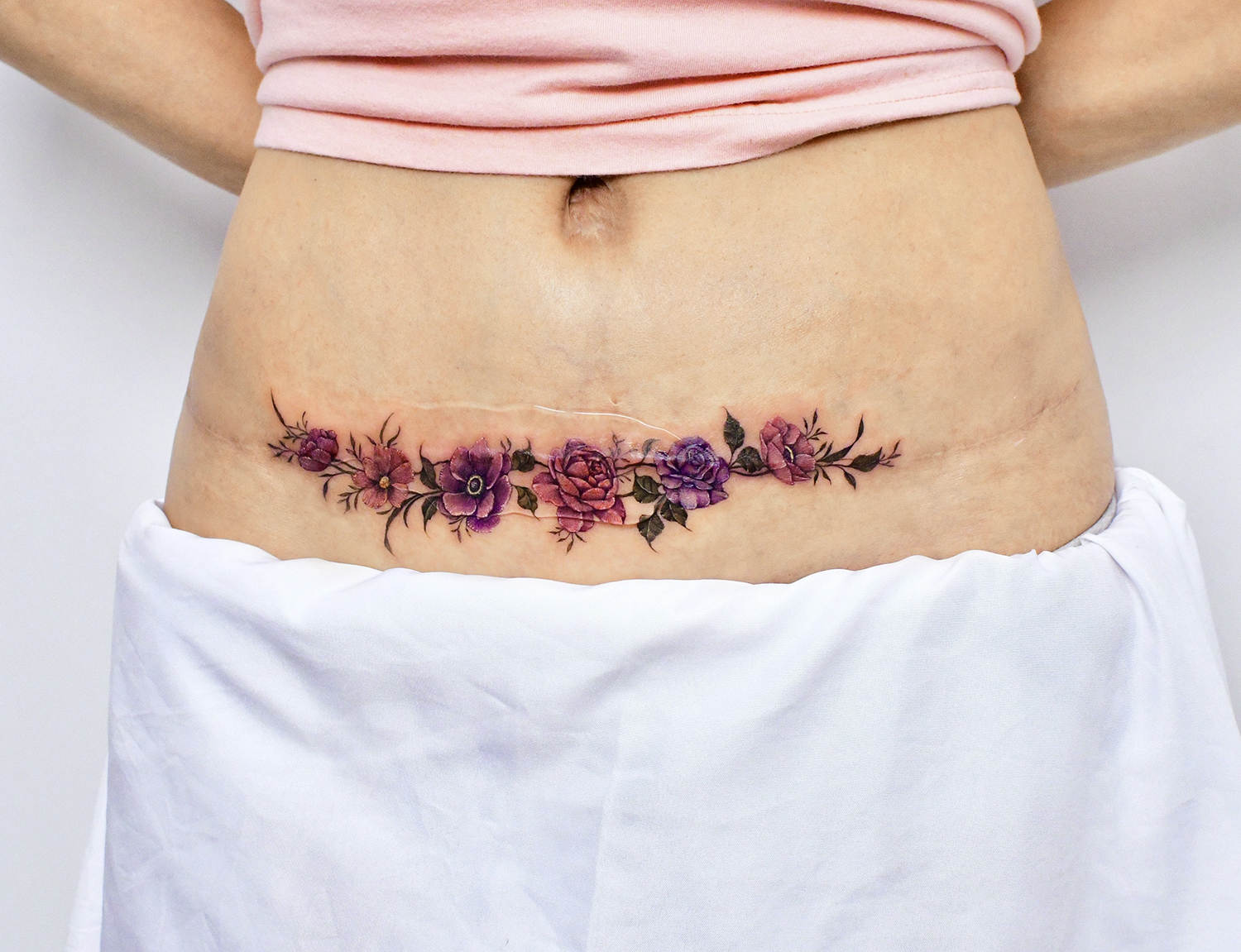 tattoo cover up over c-section scar incision, healing